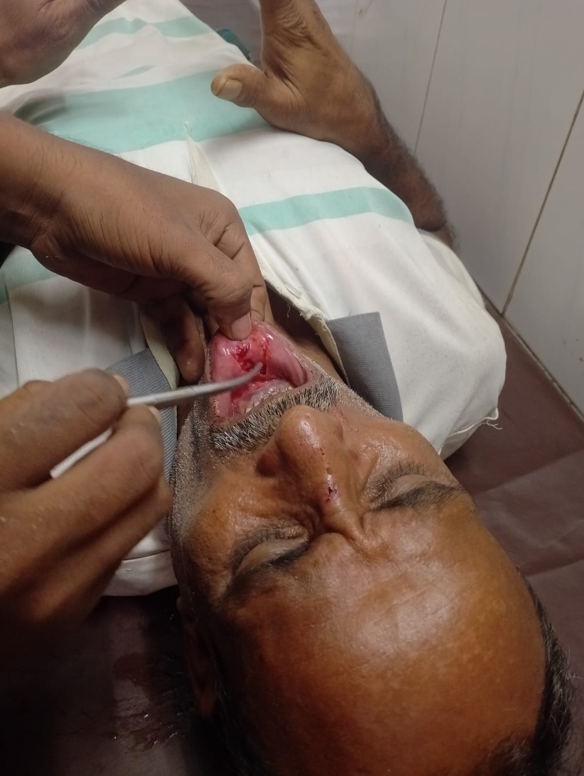 নাগেশ্বরীতে দোকানে সামনে বসে থাকা অবস্থায় বৃদ্ধের উপর অতর্কিত হামলা, গুরুতর আহত ১